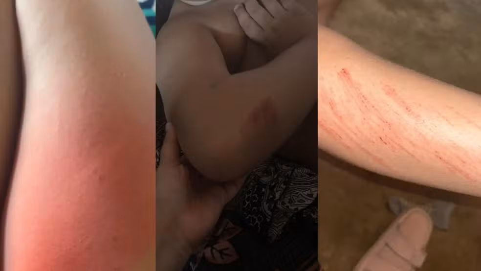 imagens-crianca-agredida-