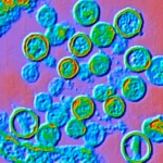Hantavirus