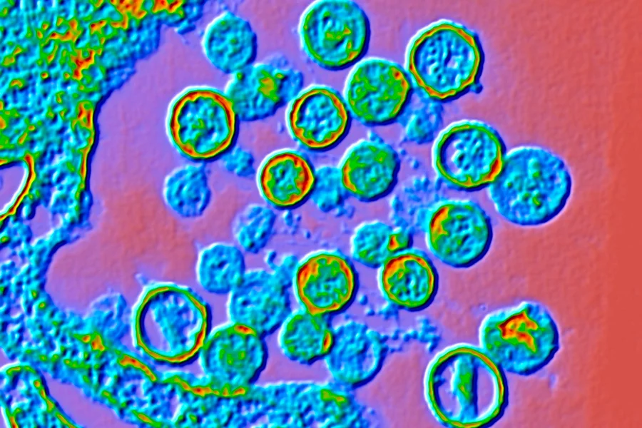 Hantavirus