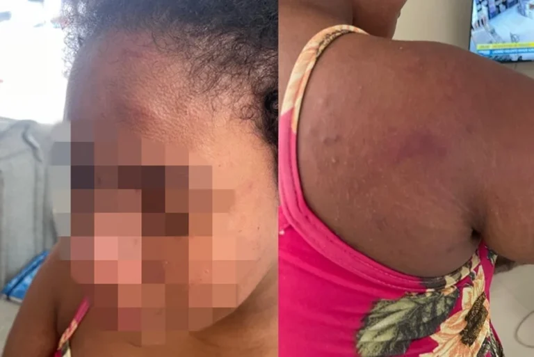 empregada-agredida-e-torturada-por-patroa-no-maranhao