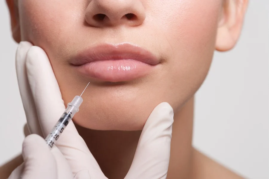 mulher-recebendo-Injecao-de-botox-de-labios