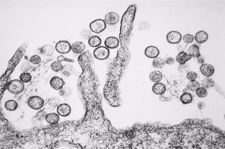 sin-nombre-hanta-virus-tem-phil-1136-lores