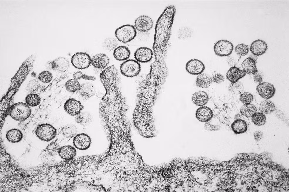 sin-nombre-hanta-virus-tem-phil-1136-lores
