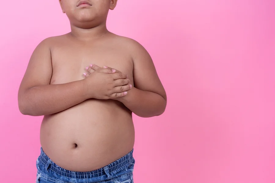 obesidade-infantil