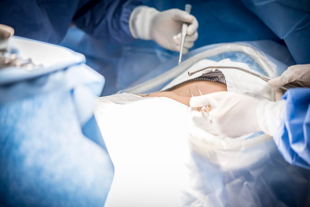 Medicos com ferramentas nas maos fazendo cirurgia na sala de operacao. Cuidados de saude e conceito de hospital
