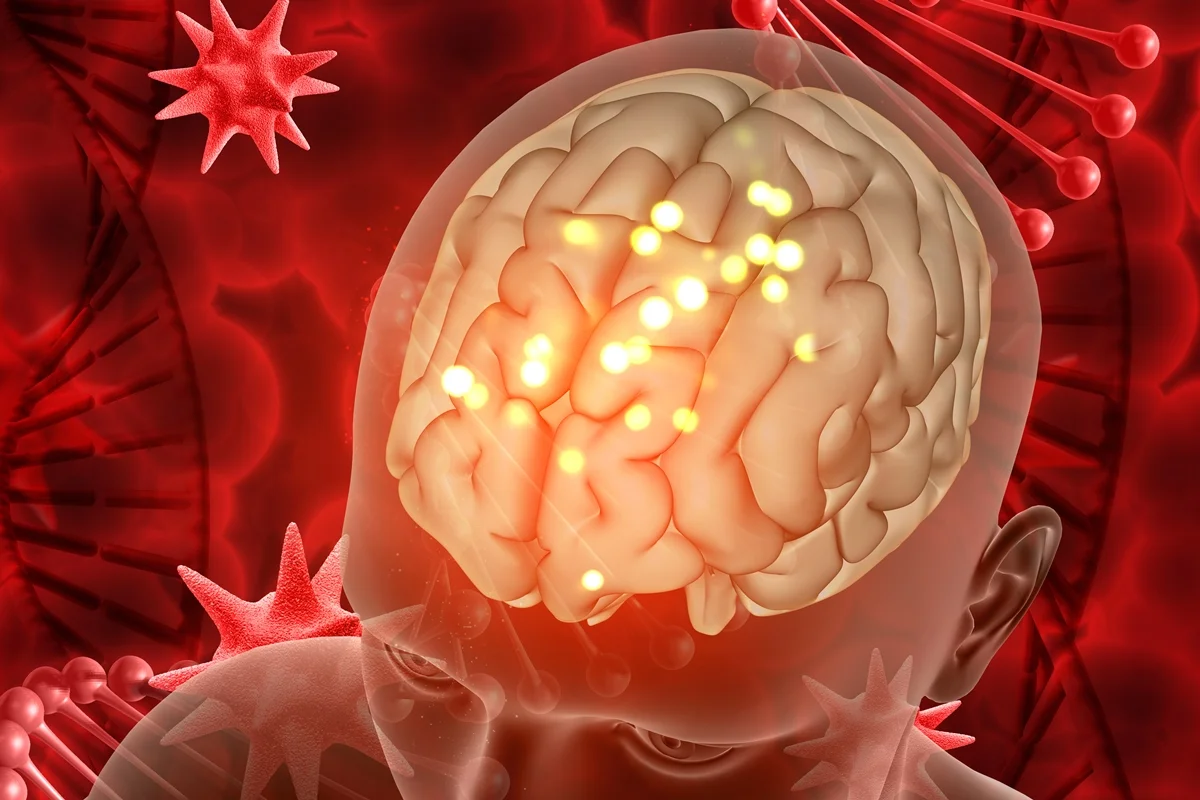 cancer no cerebro